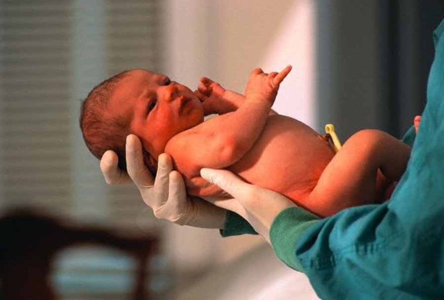 Фото только что родившегося ребенка