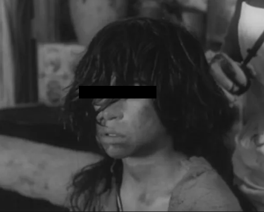 Девочка-маугли, сидевшая дома на цепи, попала в читинский приют 