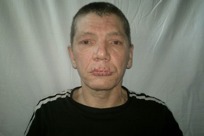 Заключенный в СИЗО Краснокаменска зашил себе рот