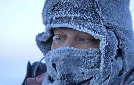 Забайкальцы все чаще получают обморожения