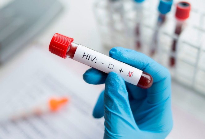 В Забайкалье выявлено 53 новых случая ВИЧ
